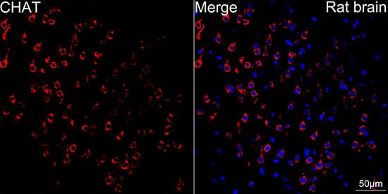 Immunocytochemistry/ Immunofluorescence: Choline Acetyltransferase/ChAT Antibody (1I4V0) [Choline Acetyltransferase/ChAT] - Confocal imaging of paraffin-embedded rat brain using CHAT Rabbit mAb  followed by a further incubation with Cy3 Goat Anti-Rabbit IgG (H+L)  . DAPI was used for nuclear staining (Blue). Objective: 40x.