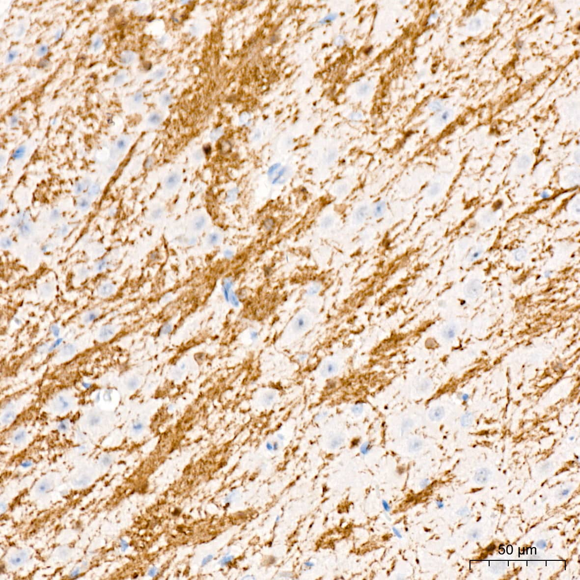 Immunohistochemistry: CNPase Antibody (8O3B6) [NBP3-15622] - Immunohistochemistry analysis of CNPase in paraffin-embedded mouse brain tissue using CNPase Rabbit mAb  at a dilution of 1:1600 (40x lens). High pressure antigen retrieval was performed with 0.01 M citrate buffer (pH 6.0) prior to IHC staining.