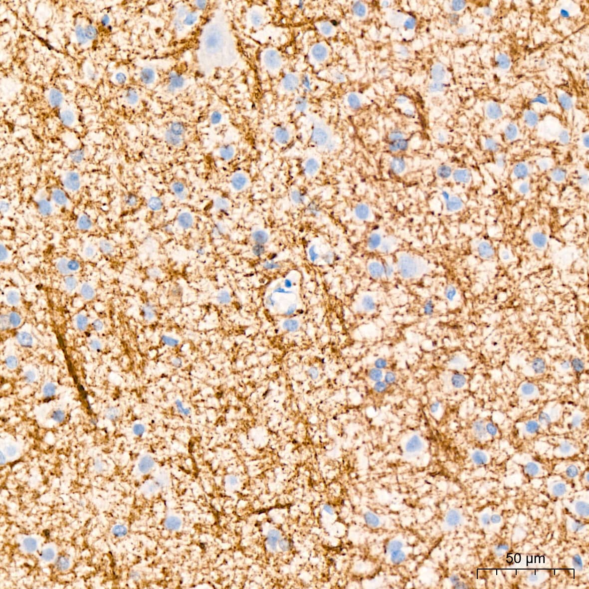 Immunohistochemistry: CNPase Antibody (8O3B6) [NBP3-15622] - Immunohistochemistry analysis of CNPase in paraffin-embedded human brain tissue using CNPase Rabbit mAb  at a dilution of 1:1600 (40x lens). High pressure antigen retrieval was performed with 0.01 M citrate buffer (pH 6.0) prior to IHC staining.