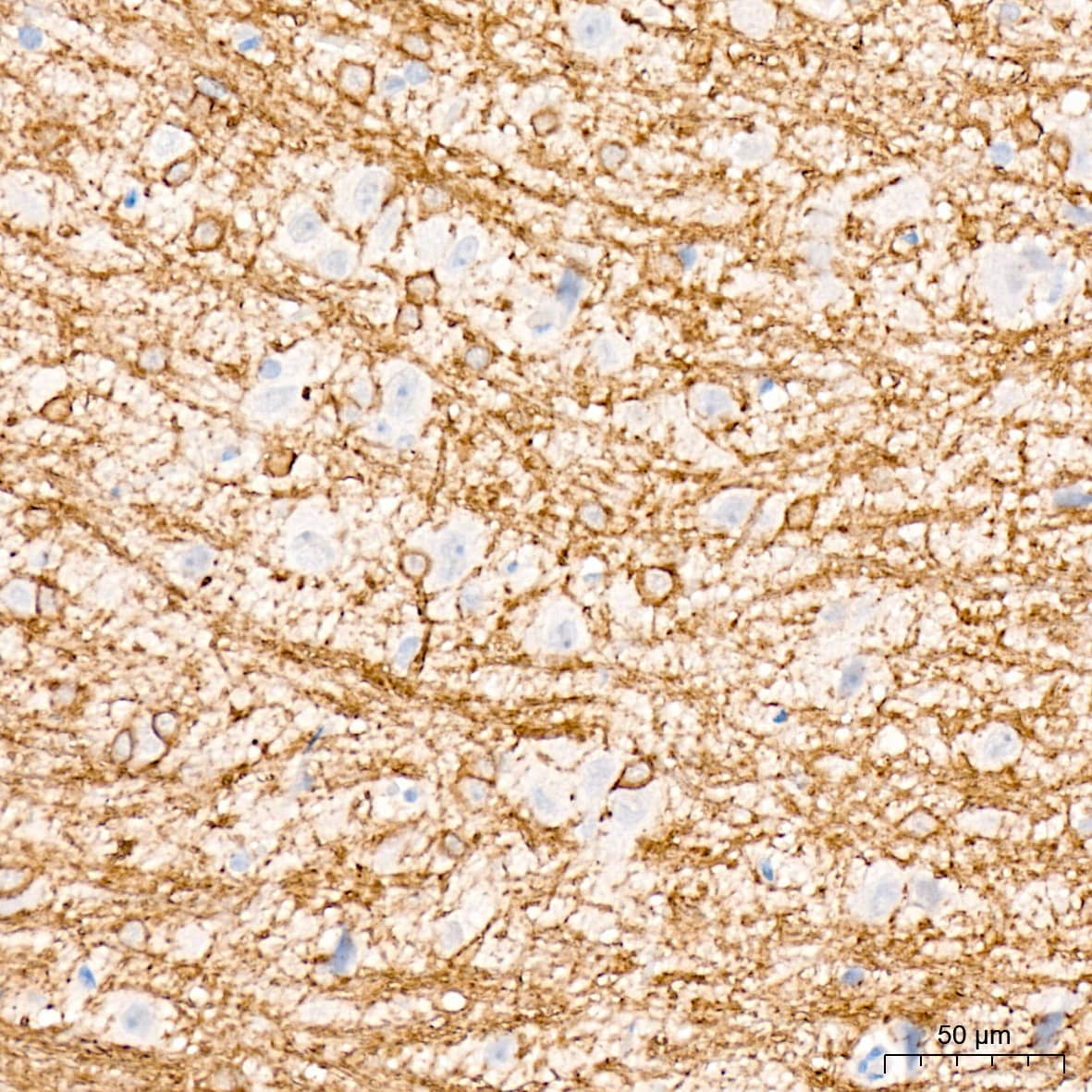 Immunohistochemistry: CNPase Antibody (8O3B6) [NBP3-15622] - Immunohistochemistry analysis of CNPase in paraffin-embedded rat brain tissue using CNPase Rabbit mAb  at a dilution of 1:1600 (40x lens). High pressure antigen retrieval was performed with 0.01 M citrate buffer (pH 6.0) prior to IHC staining.