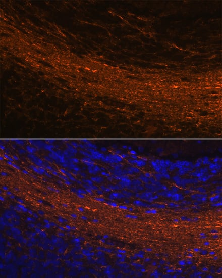 Immunocytochemistry/ Immunofluorescence: CNPase Antibody (8O3B6) [NBP3-15622] - Immunofluorescence analysis of paraffin-embedded rat brain using CNPase Rabbit mAb  at dilution of 1:100 (40x lens). Secondary antibody: Cy3 Goat Anti-Rabbit IgG (H+L)  at 1:500 dilution. Blue: DAPI for nuclear staining.