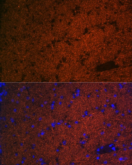 Immunocytochemistry/ Immunofluorescence: CNPase Antibody (8O3B6) [NBP3-15622] - Immunofluorescence analysis of paraffin-embedded mouse brain using CNPase Rabbit mAb  at dilution of 1:100 (40x lens). Secondary antibody: Cy3 Goat Anti-Rabbit IgG (H+L)  at 1:500 dilution. Blue: DAPI for nuclear staining.