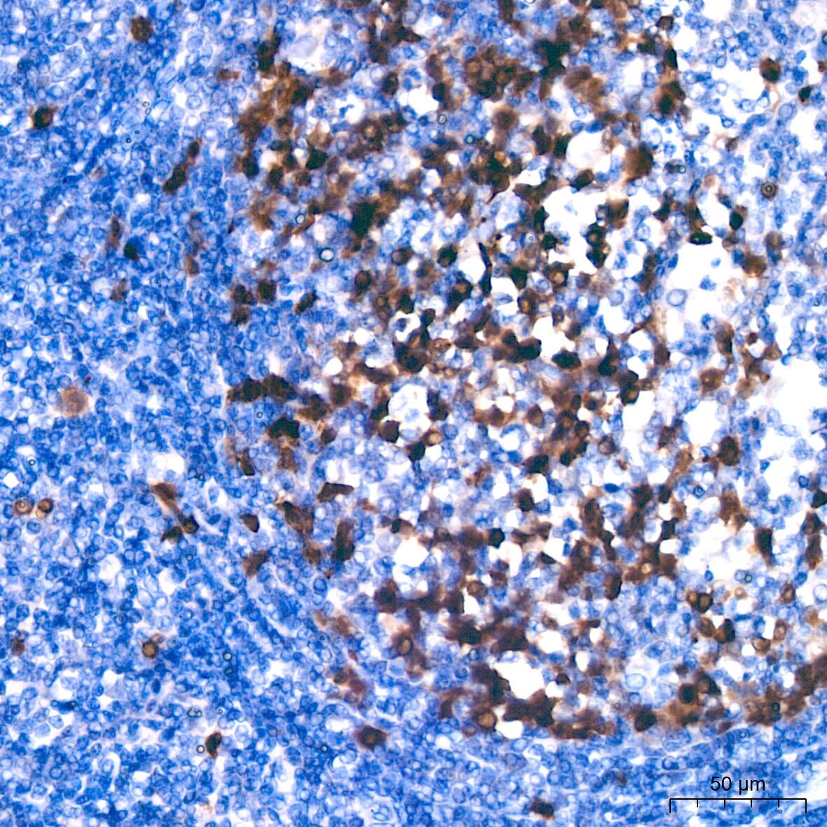 Immunohistochemistry: Cyclin A2 Antibody (3E9Z3) [Cyclin A2] - Immunohistochemistry analysis of paraffin-embedded Human tonsil using Cyclin A2 Rabbit mAb  at dilution of 1:200 (40x lens). High pressure antigen retrieval performed with 0.01M Citrate Bufferr (pH 6.0) prior to IHC staining.