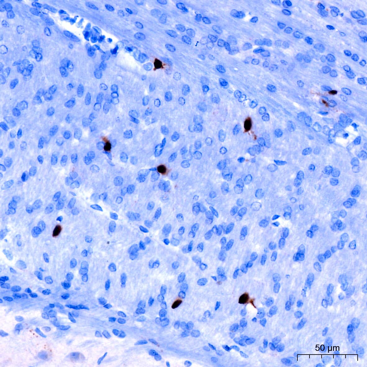 Immunohistochemistry: Cyclin A2 Antibody (3E9Z3) [Cyclin A2] - Immunohistochemistry analysis of paraffin-embedded Rat brain using Cyclin A2 Rabbit mAb  at dilution of 1:200 (40x lens). High pressure antigen retrieval performed with 0.01M Citrate Bufferr (pH 6.0) prior to IHC staining.