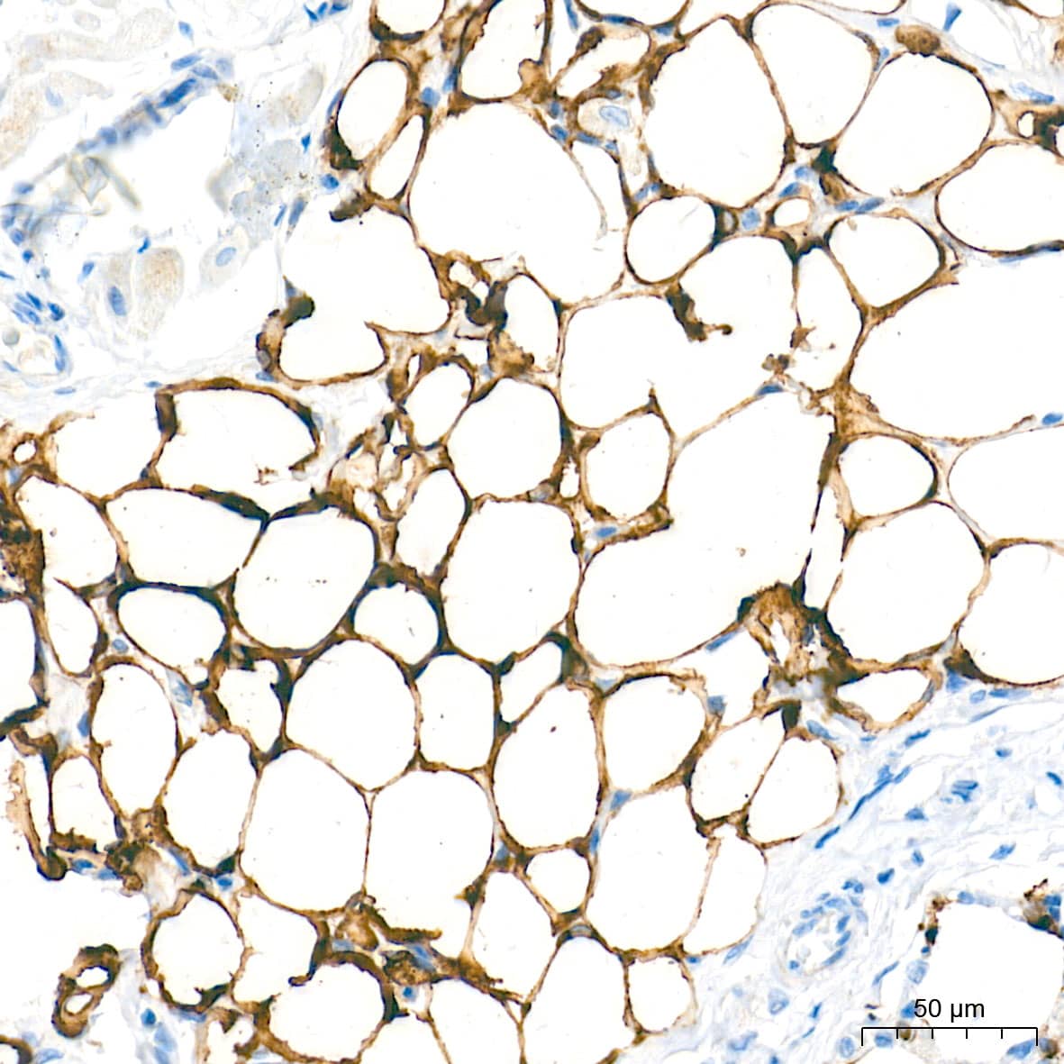 Immunohistochemistry: Fatty Acid Synthase/FASN Antibody (4U9S3) [Fatty Acid Synthase/FASN] - Immunohistochemistry analysis of paraffin-embedded Rat fat tissue using Fatty Acid Synthase/FASN Rabbit mAb  at a dilution of 1:2000 (40x lens). High pressure antigen retrieval performed with 0.01M Tris-EDTA Buffer (pH 9.0) prior to IHC staining.