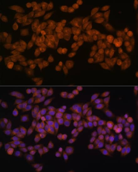 Immunocytochemistry/ Immunofluorescence: Fatty Acid Synthase/FASN Antibody (4U9S3) [Fatty Acid Synthase/FASN] - Immunofluorescence analysis of HeLa cells using Fatty Acid Synthase/FASN Rabbit mAb  at dilution of 1:100 (40x lens). Secondary antibody: Cy3-conjugated Goat anti-Rabbit IgG (H+L)  at 1:500 dilution. Blue: DAPI for nuclear staining.