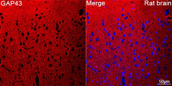 Immunocytochemistry/ Immunofluorescence: GAP-43 Antibody (8E7C8) [GAP-43] - Confocal imaging of paraffin-embedded Rat brain tissue using GAP-43 Rabbit mAb  followed by a further incubation with Cy3 Goat Anti-Rabbit IgG (H+L)  . DAPI was used for nuclear staining (Blue). Objective: 40x. Perform microwave antigen retrieval with 0.01 M citrate buffer (pH 6.0) prior to IF staining.