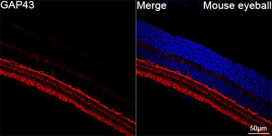 Immunocytochemistry/ Immunofluorescence: GAP-43 Antibody (8E7C8) [GAP-43] - Confocal imaging of paraffin-embedded Mouse eye tissue using GAP-43 Rabbit mAb  followed by a further incubation with Cy3 Goat Anti-Rabbit IgG (H+L)  . DAPI was used for nuclear staining (Blue). Objective: 40x. Perform high pressure antigen retrieval with 0.01 M citrate buffer (pH 6.0) prior to IF staining.