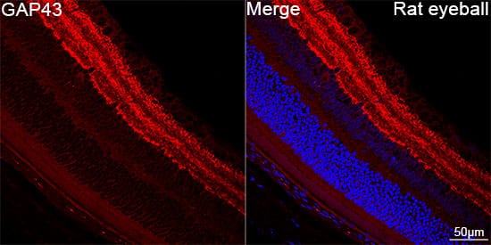 Immunocytochemistry/ Immunofluorescence: GAP-43 Antibody (8E7C8) [GAP-43] - Confocal imaging of paraffin-embedded Rat eye tissue using GAP-43 Rabbit mAb  followed by a further incubation with Cy3 Goat Anti-Rabbit IgG (H+L)  . DAPI was used for nuclear staining (Blue). Objective: 40x. Perform high pressure antigen retrieval with 0.01 M citrate buffer (pH 6.0) prior to IF staining.