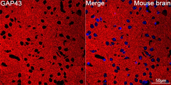 Immunocytochemistry/ Immunofluorescence: GAP-43 Antibody (8E7C8) [GAP-43] - Confocal imaging of paraffin-embedded Mouse brain tissue using GAP-43 Rabbit mAb   followed by a further incubation with Cy3 Goat Anti-Rabbit IgG (H+L)  . DAPI was used for nuclear staining (Blue). Objective: 40x. Perform microwave antigen retrieval with 0.01 M citrate buffer (pH 6.0) prior to IF staining.