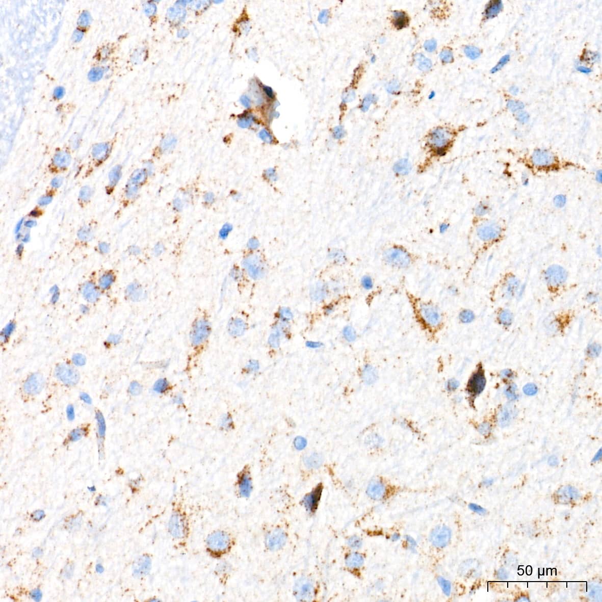 Immunohistochemistry: Glucosylceramidase/GBA Antibody (8O3Z7) [Glucosylceramidase/GBA] - Immunohistochemistry analysis of paraffin-embedded Rat brain tissue using Glucosylceramidase/GBA Rabbit mAb  at a dilution of 1:400 (40x lens). High pressure antigen retrieval performed with 0.01M Tris-EDTA Buffer (pH 9.0) prior to IHC staining.