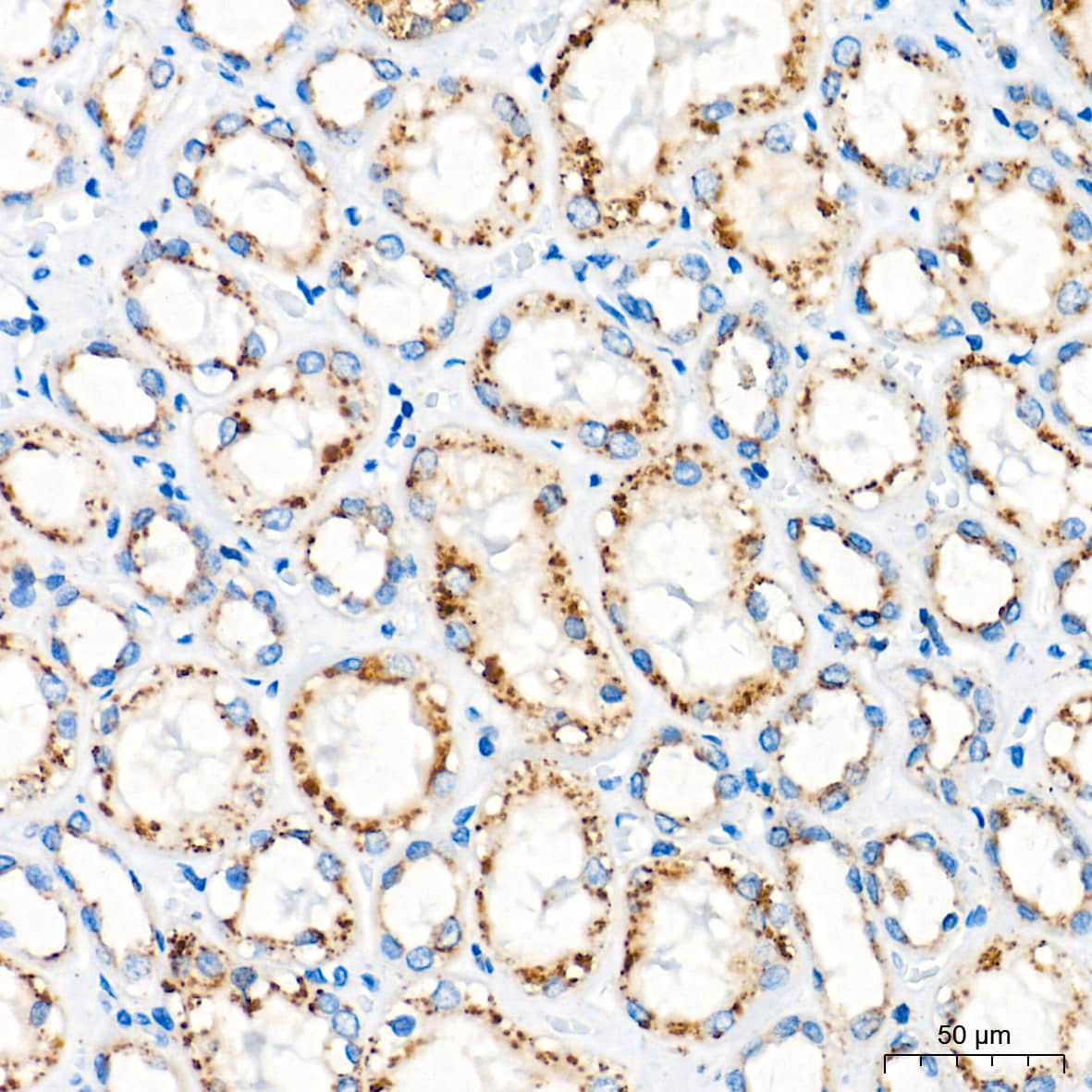 Immunohistochemistry: Glucosylceramidase/GBA Antibody (8O3Z7) [Glucosylceramidase/GBA] - Immunohistochemistry analysis of paraffin-embedded Human kidney tissue using Glucosylceramidase/GBA Rabbit mAb  at a dilution of 1:400 (40x lens). High pressure antigen retrieval performed with 0.01M Tris-EDTA Buffer (pH 9.0) prior to IHC staining.