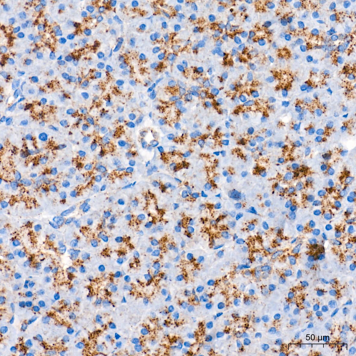 Immunohistochemistry: Glucosylceramidase/GBA Antibody (8O3Z7) [Glucosylceramidase/GBA] - Immunohistochemistry analysis of paraffin-embedded Human pancreas tissue using Glucosylceramidase/GBA Rabbit mAb  at a dilution of 1:400 (40x lens). High pressure antigen retrieval performed with 0.01M Tris-EDTA Buffer (pH 9.0) prior to IHC staining.