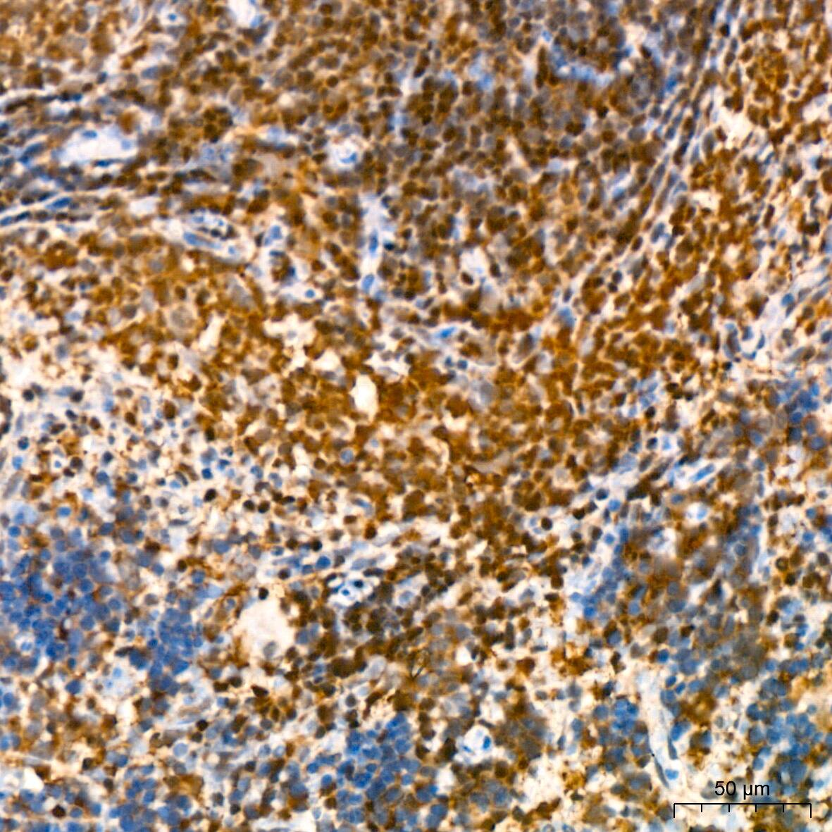 Immunohistochemistry: GRB2 Antibody (9K6H0) [GRB2] - Immunohistochemistry analysis of paraffin-embedded Rat spleen using GRB2 Rabbit mAb  at dilution of 1:200 (40x lens). High pressure antigen retrieval performed with 0.01M Citrate Bufferr (pH 6.0) prior to IHC staining.