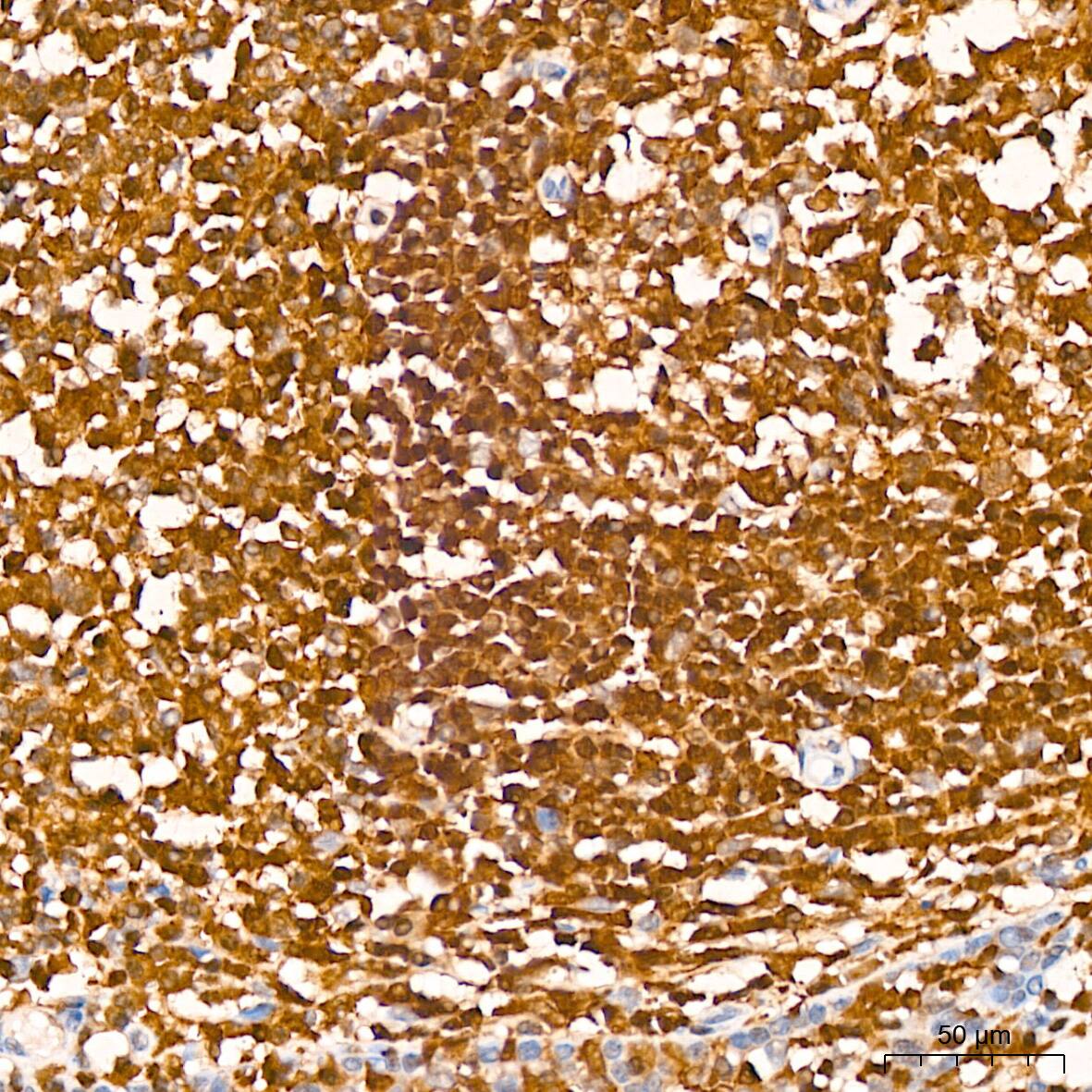 Immunohistochemistry: GRB2 Antibody (9K6H0) [GRB2] - Immunohistochemistry analysis of paraffin-embedded Human tonsil using GRB2 Rabbit mAb  at dilution of 1:200 (40x lens). High pressure antigen retrieval performed with 0.01M Citrate Bufferr (pH 6.0) prior to IHC staining.