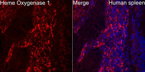 Immunocytochemistry/ Immunofluorescence: HO-1/HMOX1/HSP32 Antibody (7H7W10) [NBP3-15640] - Immunofluorescence analysis of paraffin-embedded human spleen using [KD Validated] HO-1/HMOX1/HSP32 Rabbit mAb  at dilution of 1:50 (40x lens). Secondary antibody: Cy3-conjugated Goat anti-Rabbit IgG (H+L)  at 1:500 dilution. Blue: DAPI for nuclear staining.