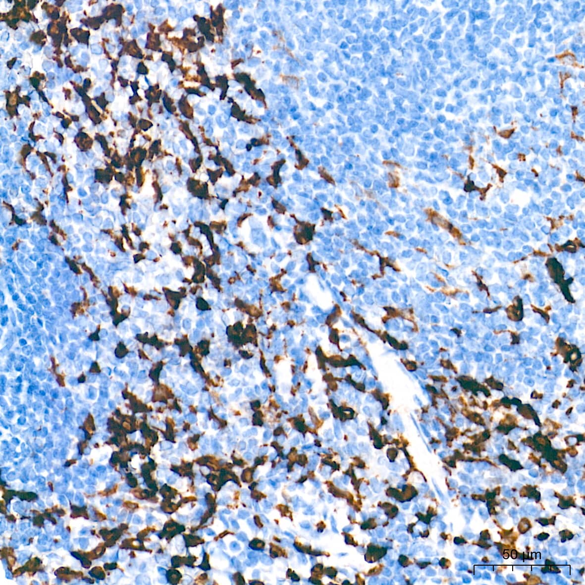 Immunohistochemistry: HO-1/HMOX1/HSP32 Antibody (7H7W10) [NBP3-15640] - Immunohistochemistry analysis of paraffin-embedded Mouse spleen tissue using [KD Validated] HO-1/HMOX1/HSP32 Rabbit mAb  at a dilution of 1:500 (40x lens). High pressure antigen retrieval performed with 0.01M Tris-EDTA Buffer (pH 9.0) prior to IHC staining.