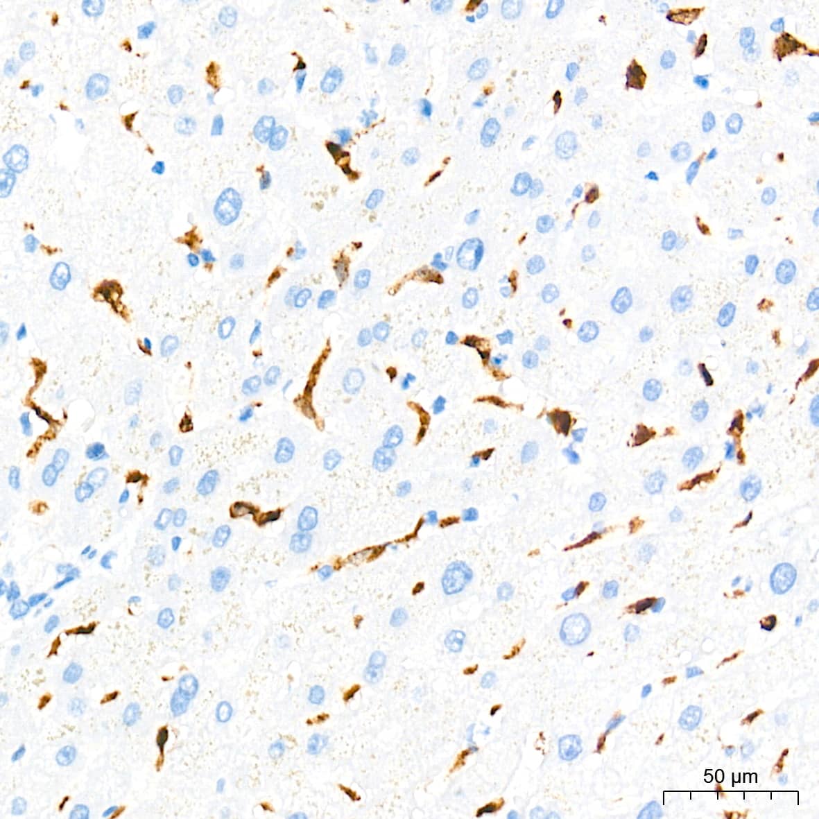 Immunohistochemistry: HO-1/HMOX1/HSP32 Antibody (7H7W10) [NBP3-15640] - Immunohistochemistry analysis of paraffin-embedded Human liver tissue using [KD Validated] HO-1/HMOX1/HSP32 Rabbit mAb  at a dilution of 1:500 (40x lens). High pressure antigen retrieval performed with 0.01M Tris-EDTA Buffer (pH 9.0) prior to IHC staining.