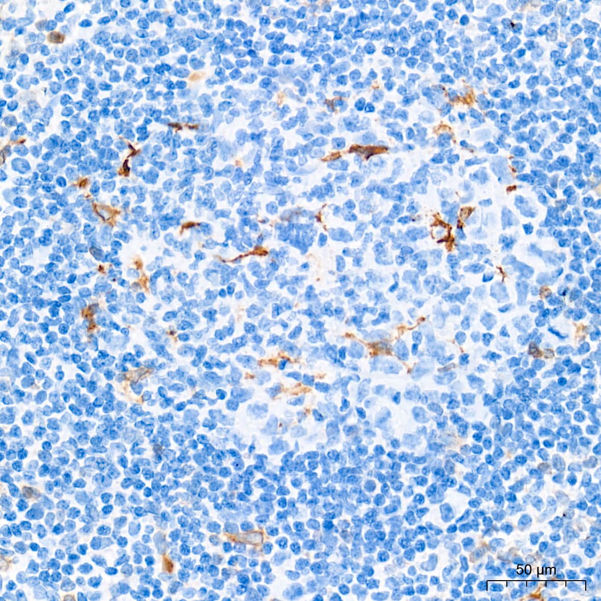 Immunohistochemistry: HO-1/HMOX1/HSP32 Antibody (7H7W10) [NBP3-15640] - Immunohistochemistry analysis of paraffin-embedded Human tonsil tissue using [KD Validated] HO-1/HMOX1/HSP32 Rabbit mAb  at a dilution of 1:500 (40x lens). High pressure antigen retrieval performed with 0.01M Tris-EDTA Buffer (pH 9.0) prior to IHC staining.