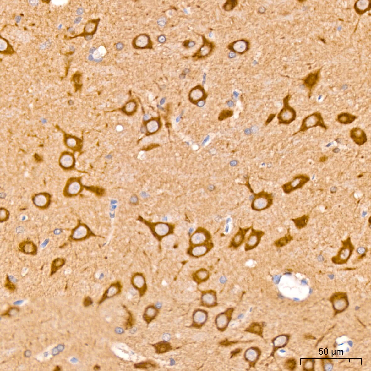 Immunohistochemistry: Huntingtin Antibody (7B9C8) [Huntingtin] - Immunohistochemistry analysis of paraffin-embedded Rat brain tissue using Huntingtin Rabbit mAb  at a dilution of 1:200 (40x lens). High pressure antigen retrieval was performed with 0.01 M citrate buffer (pH 6.0) prior to IHC staining.