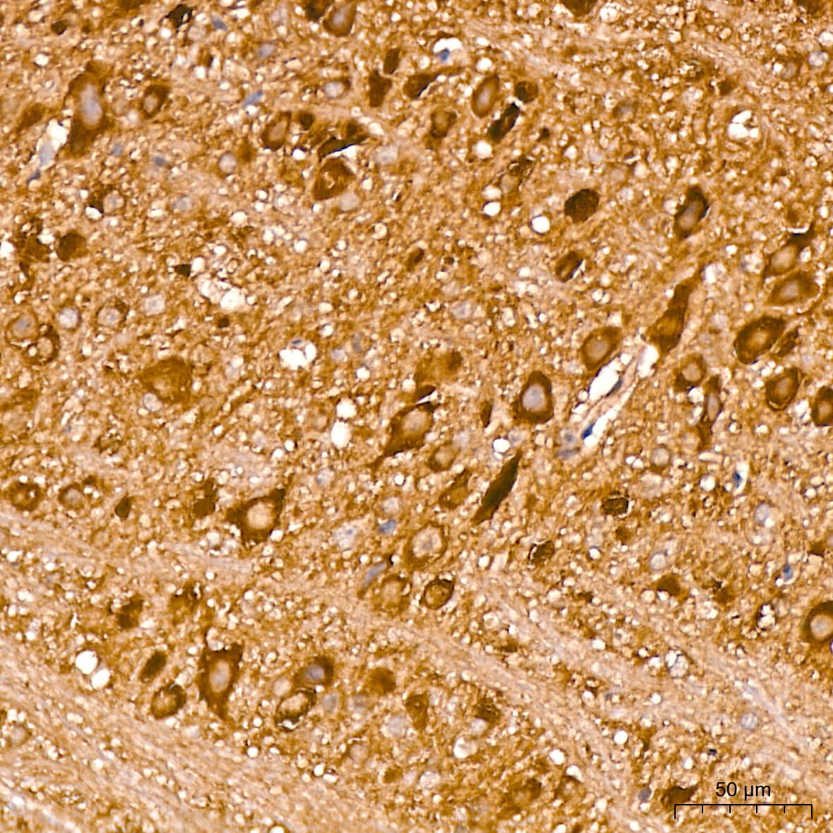 Immunohistochemistry: Huntingtin Antibody (7B9C8) [Huntingtin] - Immunohistochemistry analysis of paraffin-embedded Mouse brain tissue using Huntingtin Rabbit mAb  at a dilution of 1:200 (40x lens). High pressure antigen retrieval was performed with 0.01 M citrate buffer (pH 6.0) prior to IHC staining.