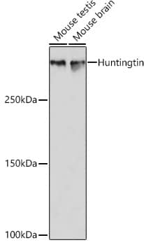 Western Blot: Huntingtin Antibody (7B9C8) [Huntingtin] - Western blot analysis of various lysates using Huntingtin Rabbit mAb  at 1:1000 dilution.Secondary antibody: HRP-conjugated Goat anti-Rabbit IgG (H+L)  at 1:10000 dilution.Lysates/proteins: 25ug per lane.Blocking buffer: 3% nonfat dry milk in TBST.Detection: ECL Basic Kit .Exposure time: 10s.