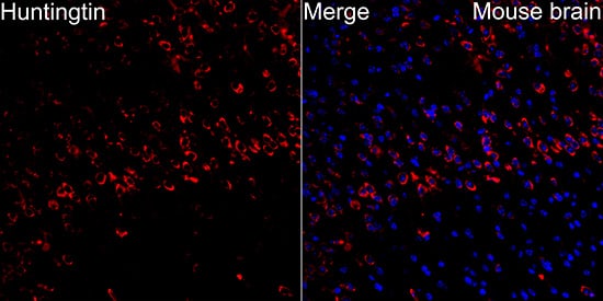 Immunocytochemistry/ Immunofluorescence Huntingtin Antibody (7B9C8)