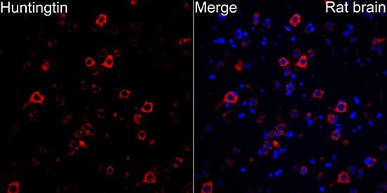 Immunocytochemistry/ Immunofluorescence: Huntingtin Antibody (7B9C8) [Huntingtin] - Immunofluorescence analysis of Rat brain tissue using Huntingtin Rabbit mAb  at a dilution of 1:100 (40x lens). Secondary antibody: Cy3-conjugated Goat anti-Rabbit IgG (H+L) at 1:500 dilution. Blue: DAPI for nuclear staining. Microwave antigen retrieval performed with 0.01M Citrate Buffer(pH 6.0) prior to IF staining.