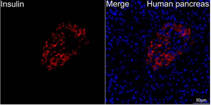 Immunohistochemistry: Insulin Antibody (4C3Y9) [NBP3-15643] -Confocal imaging of human pancreas using Insulin Rabbit mAb (at dilution of 1:100) (Red). DAPI was used for nuclear staining (blue). Objective: 40x. Perform high pressure antigen retrieval with 10 mM citrate buffer pH 6.0 before commencing with IF staining protocol.