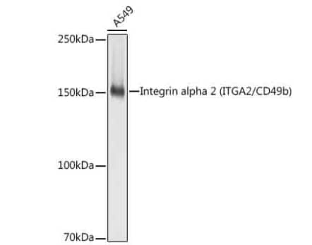 Western Blot: Integrin alpha 2/CD49b Antibody (7O9H6) [NBP3-15644] - Analysis of lysates from A549 cells, using [KO Validated] Integrin alpha 2 Rabbit mAb at 1:1000 dilution.Secondary antibody: HRP-conjugated Goat anti-Rabbit IgG (H+L) at 1:10000 dilution.Lysates/proteins: 25μg per lane.Blocking buffer: 3% nonfat dry milk in TBST.Detection: ECL Basic Kit. Exposure time: 1s.