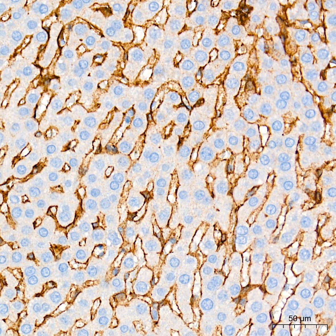 Immunohistochemistry: Integrin alpha V/CD51 Antibody (10T9N2) [Integrin alpha V/CD51] - Immunohistochemistry analysis of paraffin-embedded Rat liver tissue using Integrin alpha V/CD51 Rabbit mAb  at a dilution of 1:2000 (40x lens). High pressure antigen retrieval performed with 0.01M Tris-EDTA Buffer (pH 9.0) prior to IHC staining.