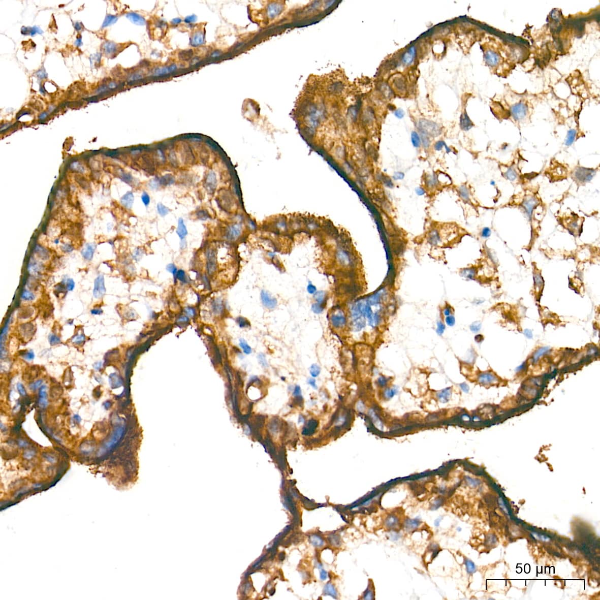 Immunohistochemistry: Integrin alpha V/CD51 Antibody (10T9N2) [Integrin alpha V/CD51] - Immunohistochemistry analysis of paraffin-embedded Human placenta tissue using Integrin alpha V/CD51 Rabbit mAb  at a dilution of 1:2000 (40x lens). High pressure antigen retrieval performed with 0.01M Tris-EDTA Buffer (pH 9.0) prior to IHC staining.