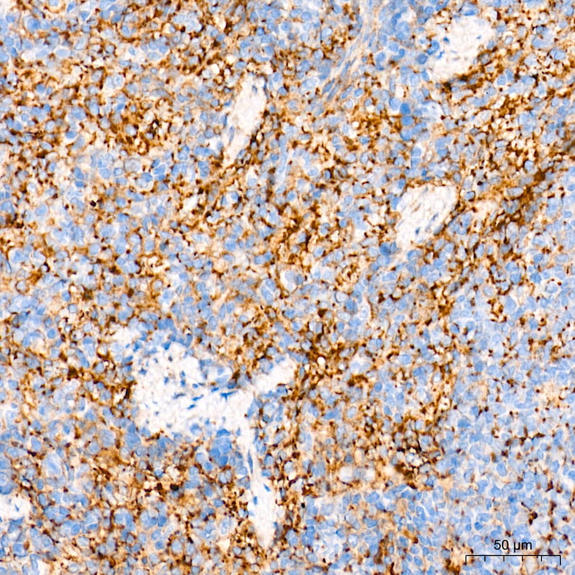 Immunohistochemistry: Integrin alpha V/CD51 Antibody (10T9N2) [Integrin alpha V/CD51] - Immunohistochemistry analysis of paraffin-embedded Rat spleen tissue using Integrin alpha V/CD51 Rabbit mAb  at a dilution of 1:2000 (40x lens). High pressure antigen retrieval performed with 0.01M Tris-EDTA Buffer (pH 9.0) prior to IHC staining.