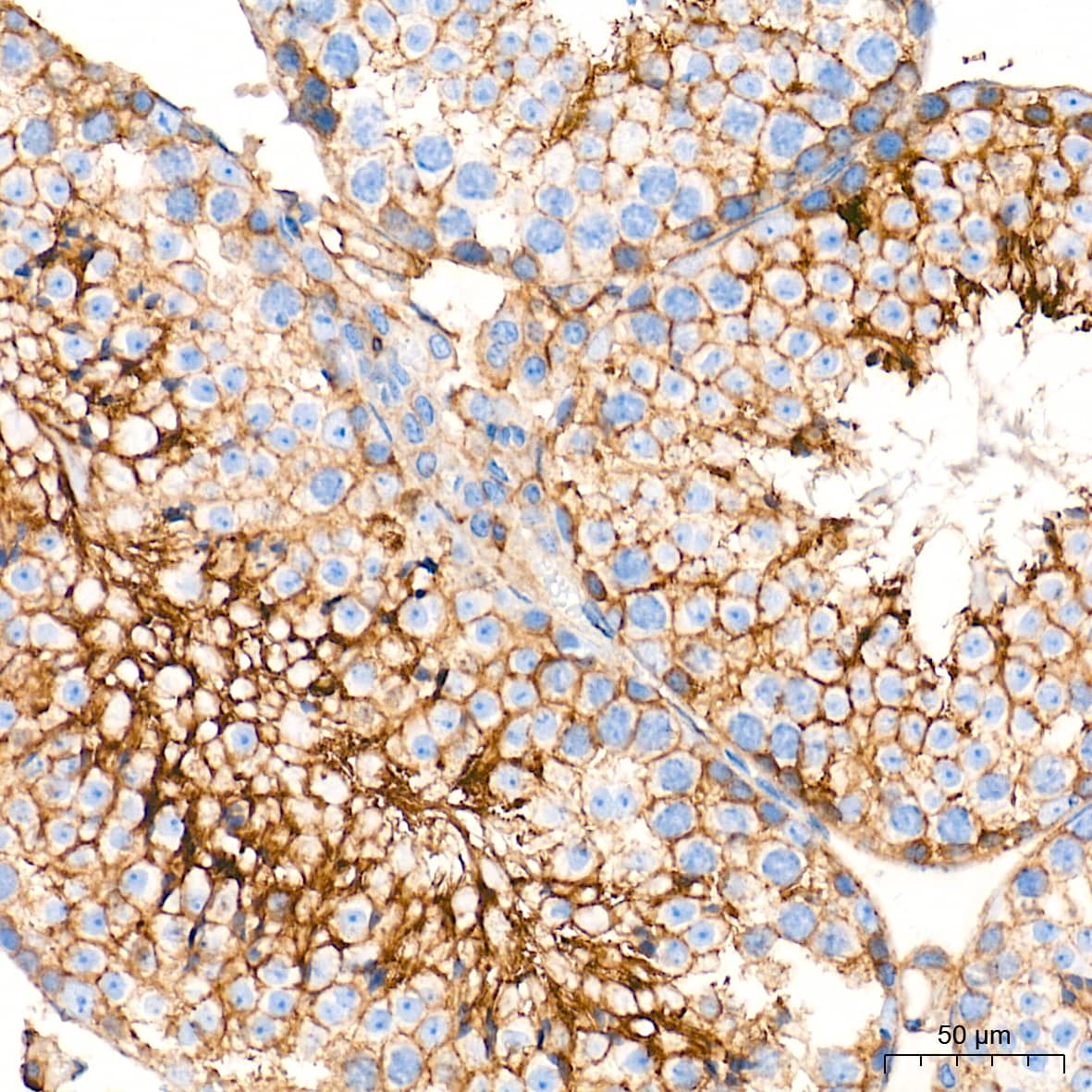 Immunohistochemistry: Integrin alpha V/CD51 Antibody (10T9N2) [Integrin alpha V/CD51] - Immunohistochemistry analysis of paraffin-embedded Mouse testis tissue using Integrin alpha V/CD51 Rabbit mAb  at a dilution of 1:2000 (40x lens). High pressure antigen retrieval performed with 0.01M Tris-EDTA Buffer (pH 9.0) prior to IHC staining.