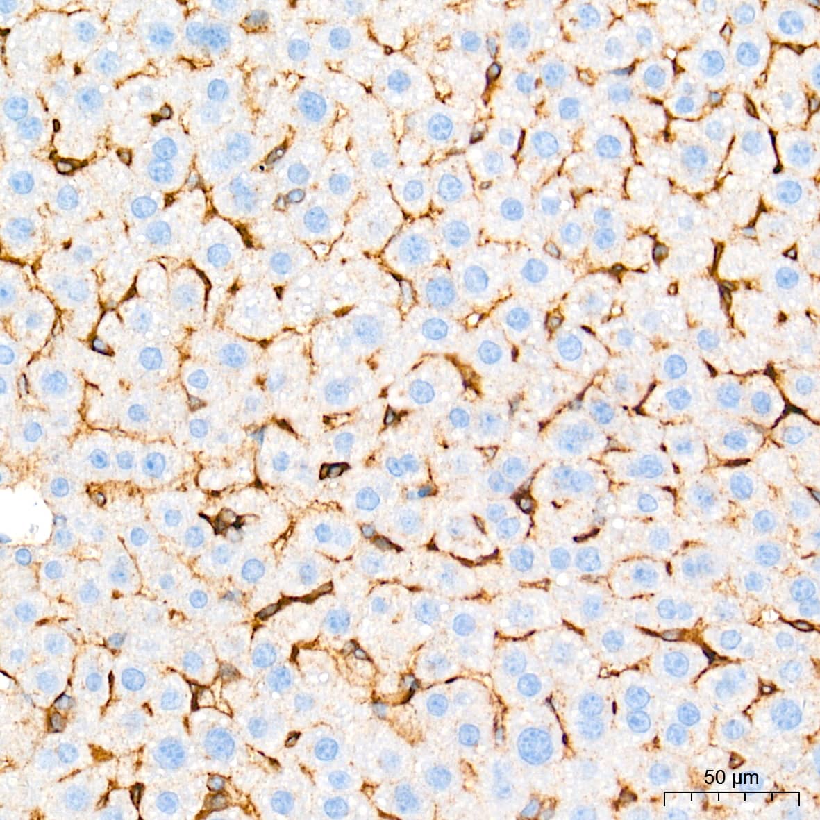 Immunohistochemistry: Integrin alpha V/CD51 Antibody (10T9N2) [Integrin alpha V/CD51] - Immunohistochemistry analysis of paraffin-embedded Mouse liver tissue using Integrin alpha V/CD51 Rabbit mAb  at a dilution of 1:2000 (40x lens). High pressure antigen retrieval performed with 0.01M Tris-EDTA Buffer (pH 9.0) prior to IHC staining.