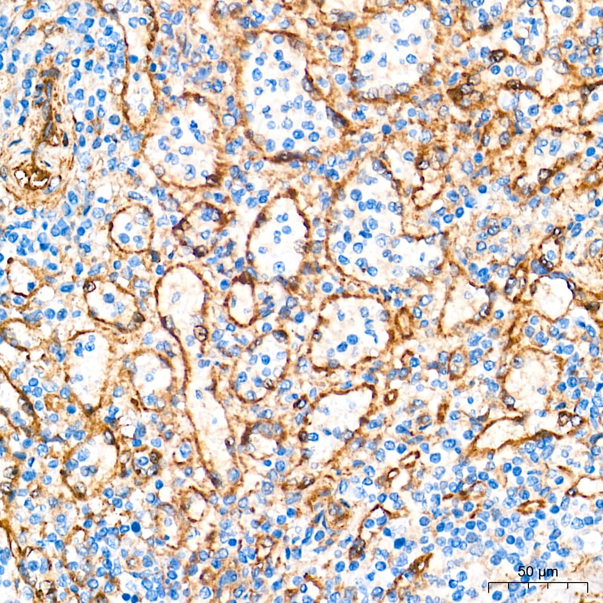 Immunohistochemistry: Integrin alpha V/CD51 Antibody (10T9N2) [Integrin alpha V/CD51] - Immunohistochemistry analysis of paraffin-embedded Human spleen tissue using Integrin alpha V/CD51 Rabbit mAb  at a dilution of 1:2000 (40x lens). High pressure antigen retrieval performed with 0.01M Tris-EDTA Buffer (pH 9.0) prior to IHC staining.