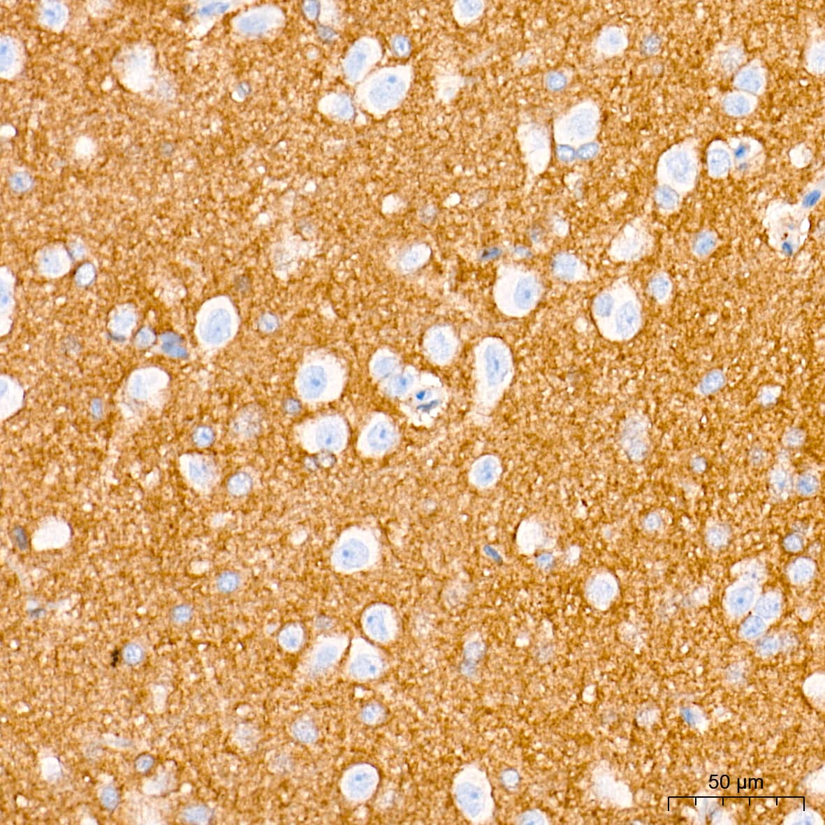 Immunohistochemistry: Integrin alpha V/CD51 Antibody (10T9N2) [Integrin alpha V/CD51] - Immunohistochemistry analysis of paraffin-embedded Rat brain tissue using Integrin alpha V/CD51 Rabbit mAb  at a dilution of 1:2000 (40x lens). High pressure antigen retrieval performed with 0.01M Tris-EDTA Buffer (pH 9.0) prior to IHC staining.