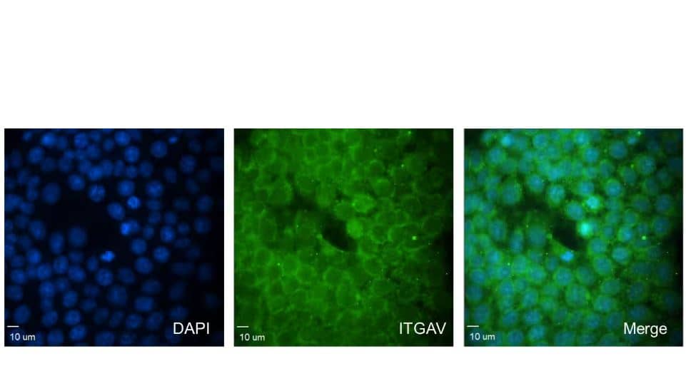 ICC/IF: Integrin alpha V/CD51 Antibody (7O8N2) [NBP3-15647] -ITGAV Antibody [NBP3-15647] was used (1:100) for labeling and microscopy analysis of the distribution of ITGAV proteins in SUM159 cells. Validated customer review.