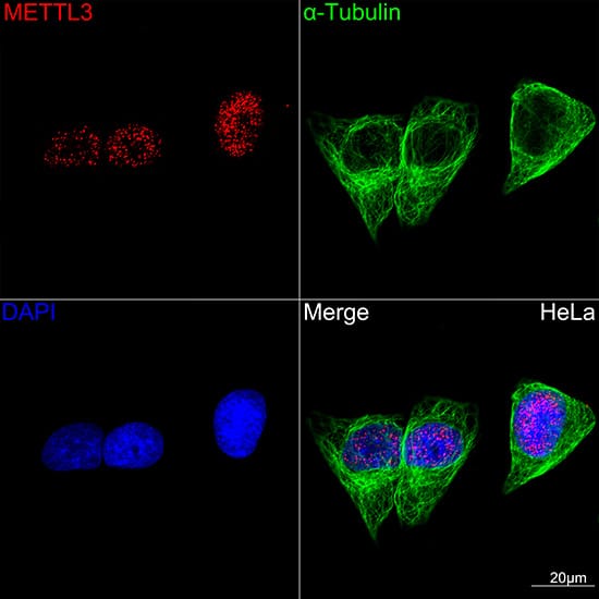 Immunocytochemistry/ Immunofluorescence: Methyltransferase like 3 Antibody (1R6X6) [Methyltransferase like 3] - Confocal imaging of HeLa cells using Methyltransferase like 3 Rabbit mAb . The cells were counterstained with alpha-Tubulin Mouse mAb  (Green). DAPI was used for nuclear staining (blue). Objective: 100x.
