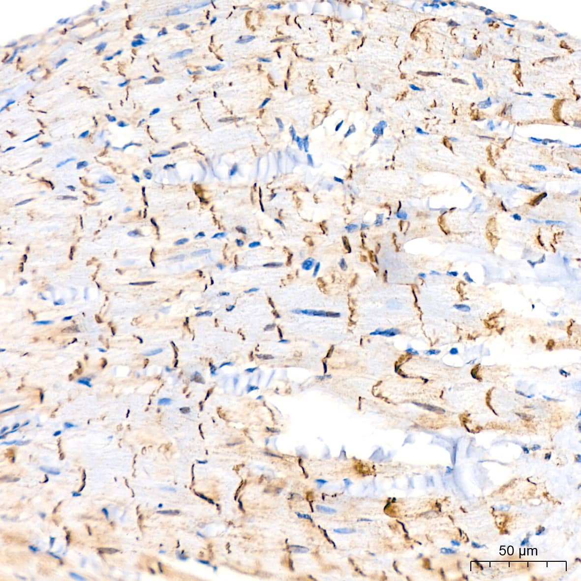 <b>Genetic Strategies Validation. </b>Immunohistochemistry: N-Cadherin Antibody (6F9G8) [N-Cadherin] - Immunohistochemistry analysis of paraffin-embedded Rat heart tissue using [KO Validated] N-Cadherin Rabbit mAb  at a dilution of 1:200 (40x lens). High pressure antigen retrieval performed with 0.01M Citrate Buffer (pH 6.0) prior to IHC staining.