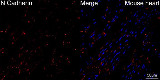 Immunocytochemistry/ Immunofluorescence: N-Cadherin Antibody (6F9G8) [N-Cadherin] - Confocal imaging of paraffin-embedded Mouse heart using [KO Validated] N-Cadherin Rabbit mAb  followed by a further incubation with Cy3 Goat Anti-Rabbit IgG (H+L)  . DAPI was used for nuclear staining (Blue). Objective: 40x. High pressure antigen retrieval performed with 0.01M Citrate Buffer(pH 6.0) prior to IF staining.