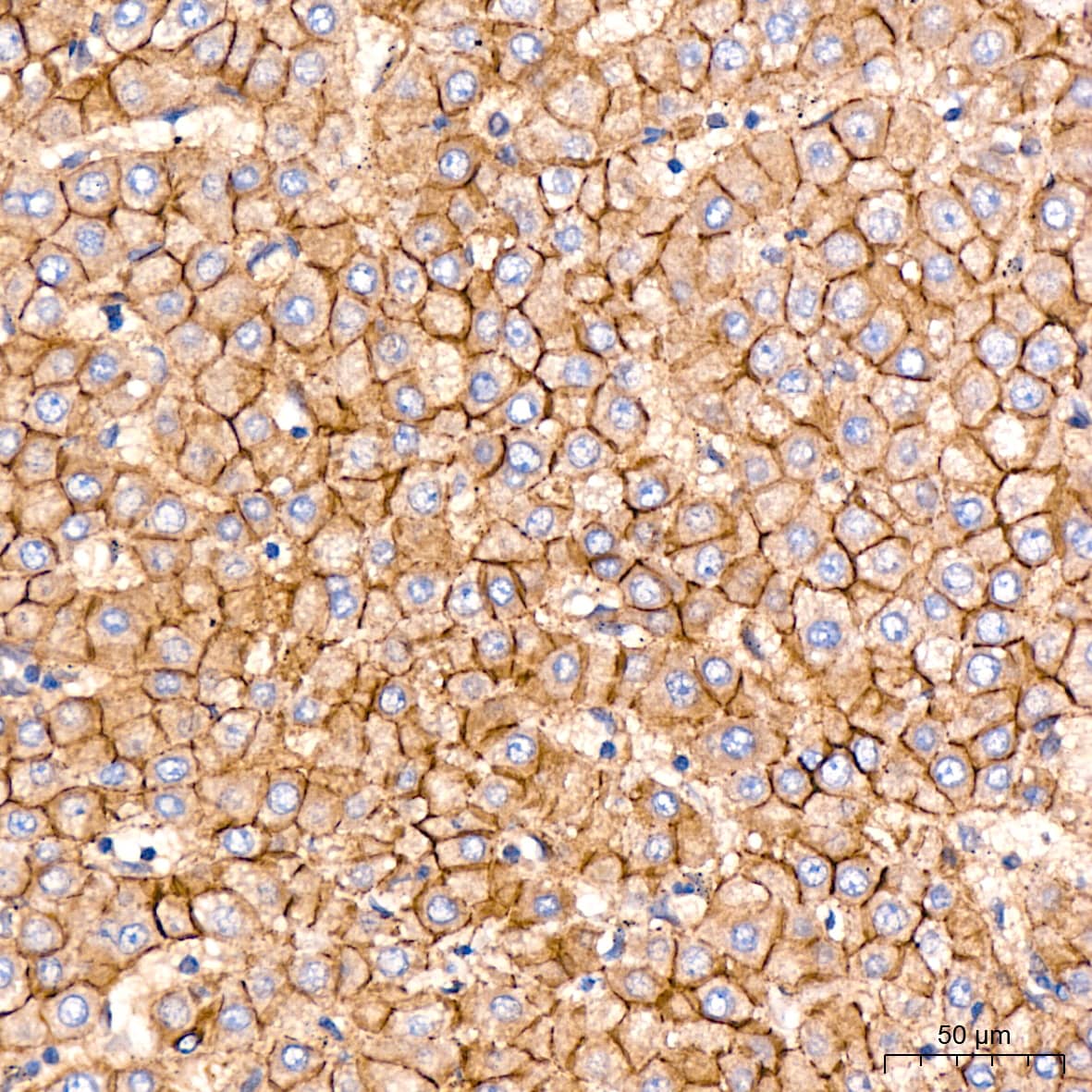 Immunohistochemistry: N-Cadherin Antibody (6F9G8) [N-Cadherin] - Immunohistochemistry analysis of paraffin-embedded Human liver tissue using [KO Validated] N-Cadherin Rabbit mAb  at a dilution of 1:200 (40x lens). High pressure antigen retrieval performed with 0.01M Citrate Buffer (pH 6.0) prior to IHC staining.