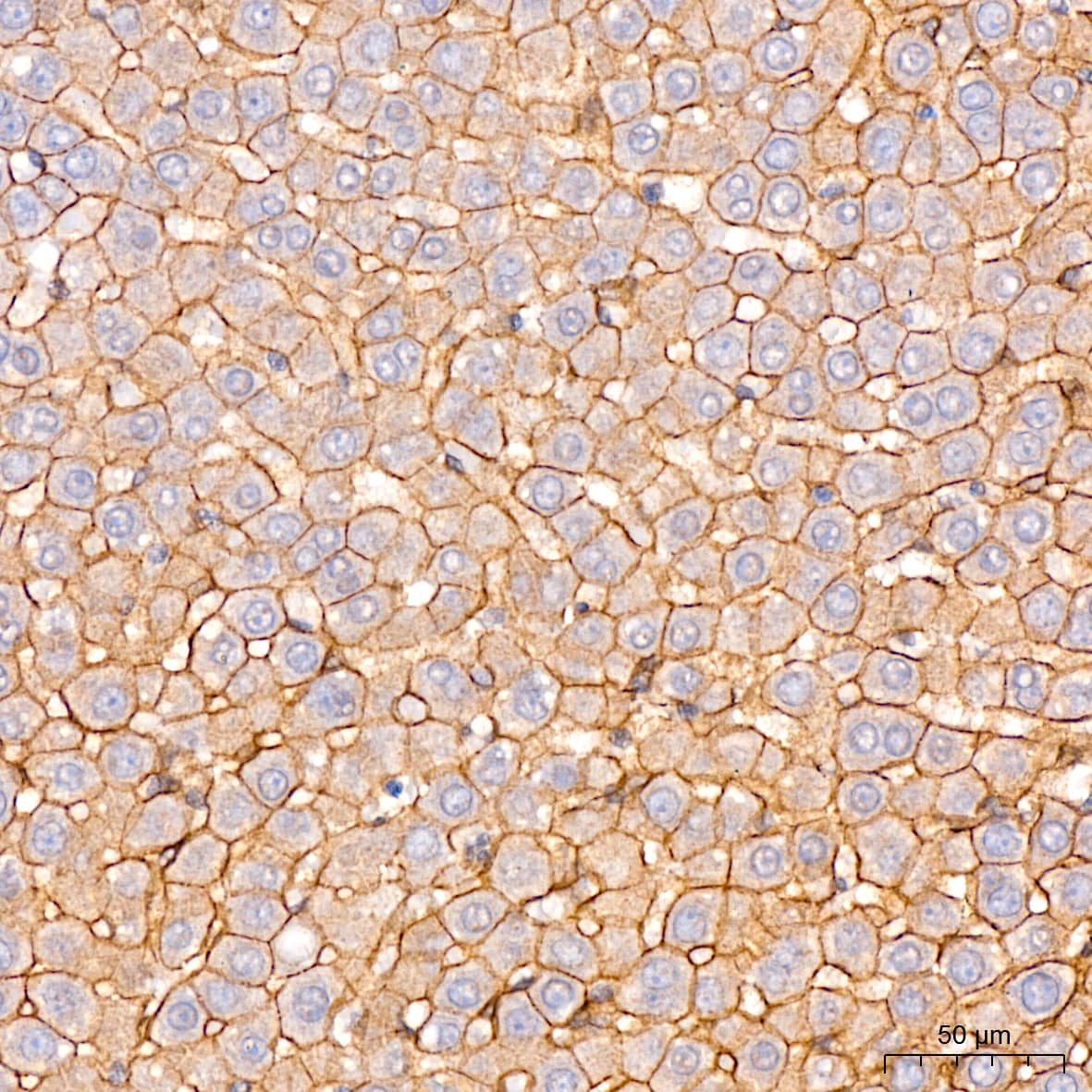 Immunohistochemistry: N-Cadherin Antibody (6F9G8) [N-Cadherin] - Immunohistochemistry analysis of paraffin-embedded Rat liver tissue using [KO Validated] N-Cadherin Rabbit mAb  at a dilution of 1:200 (40x lens). High pressure antigen retrieval performed with 0.01M Citrate Buffer (pH 6.0) prior to IHC staining.