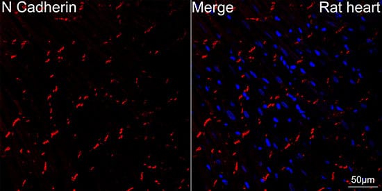 Immunocytochemistry/ Immunofluorescence: N-Cadherin Antibody (6F9G8) [N-Cadherin] - Confocal imaging of paraffin-embedded rat heart using [KO Validated] N-Cadherin Rabbit mAb  followed by a further incubation with Cy3 Goat Anti-Rabbit IgG (H+L)  . DAPI was used for nuclear staining (Blue). Objective: 40x. High pressure antigen retrieval performed with 0.01M Citrate Buffer(pH 6.0) prior to IF staining.