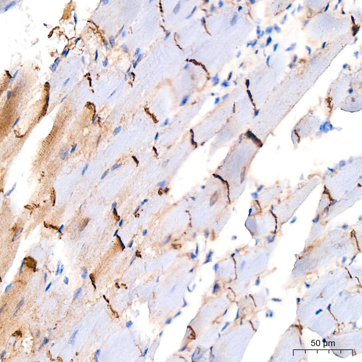 Immunohistochemistry: N-Cadherin Antibody (6F9G8) [N-Cadherin] - Immunohistochemistry analysis of paraffin-embedded Mouse heart tissue using [KO Validated] N-Cadherin Rabbit mAb  at a dilution of 1:200 (40x lens). High pressure antigen retrieval performed with 0.01M Citrate Buffer (pH 6.0) prior to IHC staining.