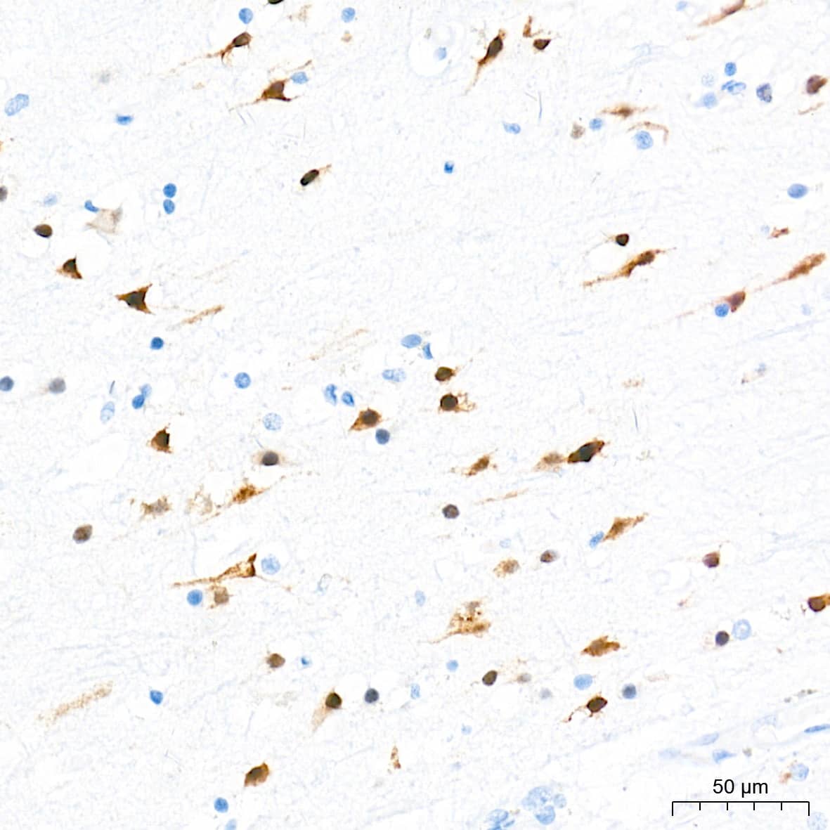 Immunohistochemistry: RBFOX3/NeuN Antibody (2F9F0) [RBFOX3/NeuN] - Immunohistochemistry analysis of paraffin-embedded Human brain tissue using RBFOX3/NeuN Rabbit mAb  at a dilution of 1:2000 (40x lens). High pressure antigen retrieval performed with 0.01M Tris-EDTA Buffer(pH 9.0) prior to IHC staining.