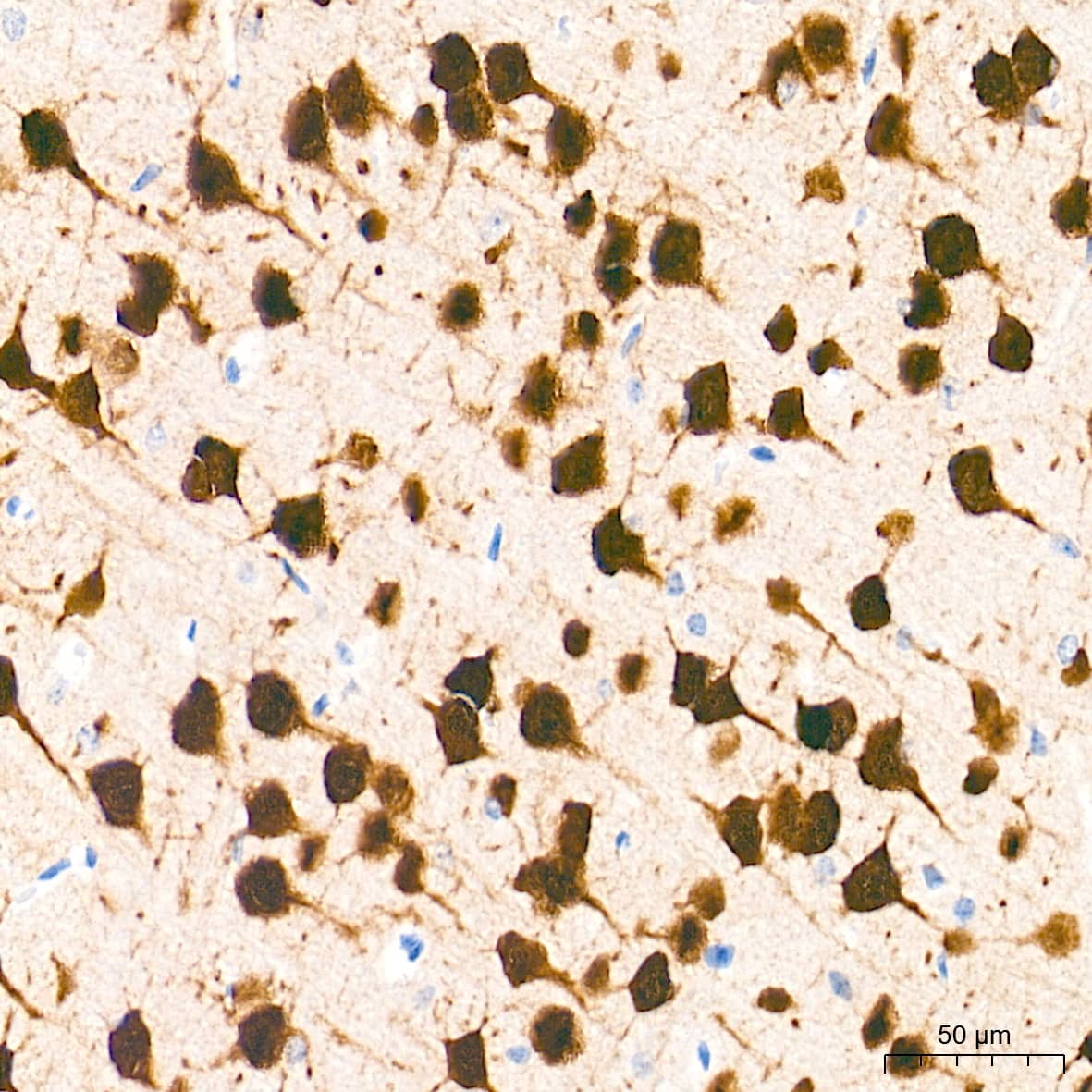 Immunohistochemistry: RBFOX3/NeuN Antibody (2F9F0) [RBFOX3/NeuN] - Immunohistochemistry analysis of paraffin-embedded Mouse brain tissue using RBFOX3/NeuN Rabbit mAb  at a dilution of 1:2000 (40x lens). High pressure antigen retrieval performed with 0.01M Tris-EDTA Buffer(pH 9.0) prior to IHC staining.