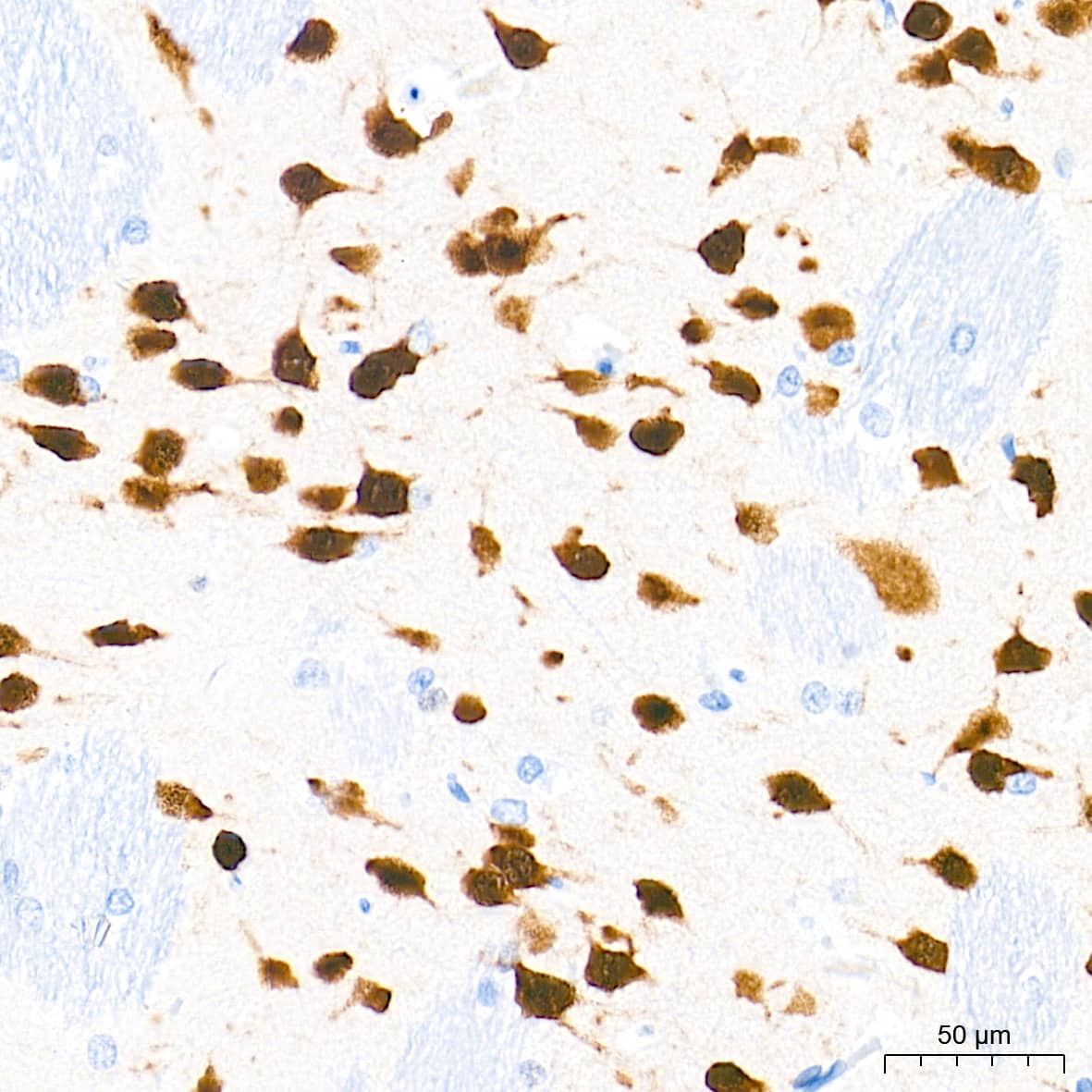 Immunohistochemistry: RBFOX3/NeuN Antibody (2F9F0) [RBFOX3/NeuN] - Immunohistochemistry analysis of paraffin-embedded Rat brain tissue using RBFOX3/NeuN Rabbit mAb  at a dilution of 1:2000 (40x lens). High pressure antigen retrieval performed with 0.01M Tris-EDTA Buffer(pH 9.0) prior to IHC staining.