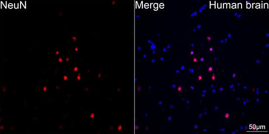 Immunocytochemistry/ Immunofluorescence: RBFOX3/NeuN Antibody (2F9F0) [RBFOX3/NeuN] - Confocal imaging of paraffin-embedded human brain tissue using RBFOX3/NeuN Rabbit mAb  followed by a further incubation with Cy3 Goat Anti-Rabbit IgG (H+L)  . DAPI was used for nuclear staining (Blue). High pressure antigen retrieval performed with 0.01M Citrate Buffer (pH 6.0) prior to IF staining. Objective: 40x.