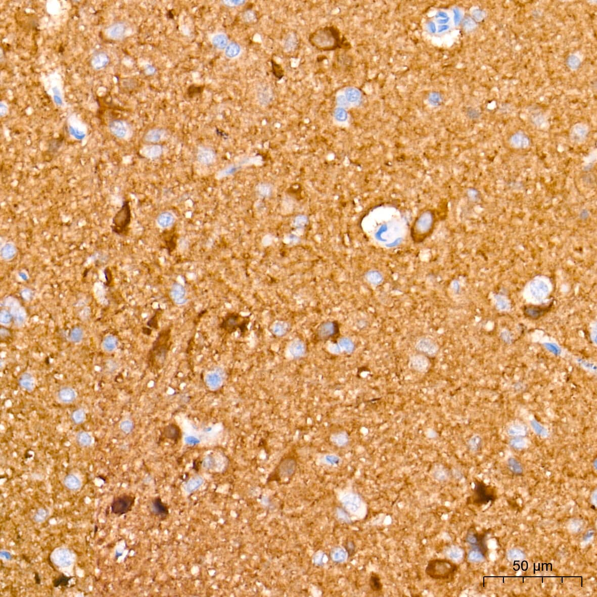 Immunohistochemistry: Enolase 2/Neuron-specific Enolase Antibody (9B4Y4) [Enolase 2/Neuron-specific Enolase] - Immunohistochemistry analysis of paraffin-embedded Rat brain tissue using Enolase 2/Neuron-specific Enolase Rabbit mAb  at a dilution of 1:2000 (40x lens). High pressure antigen retrieval performed with 0.01M Tris-EDTA Buffer (pH 9.0) prior to IHC staining.